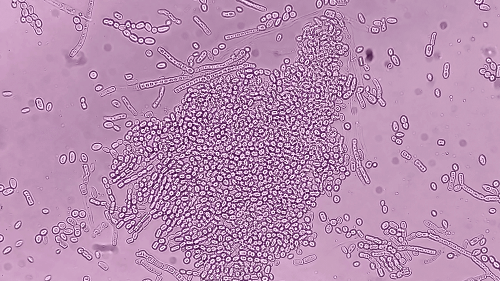 Malassezia and the gut-scalp axis