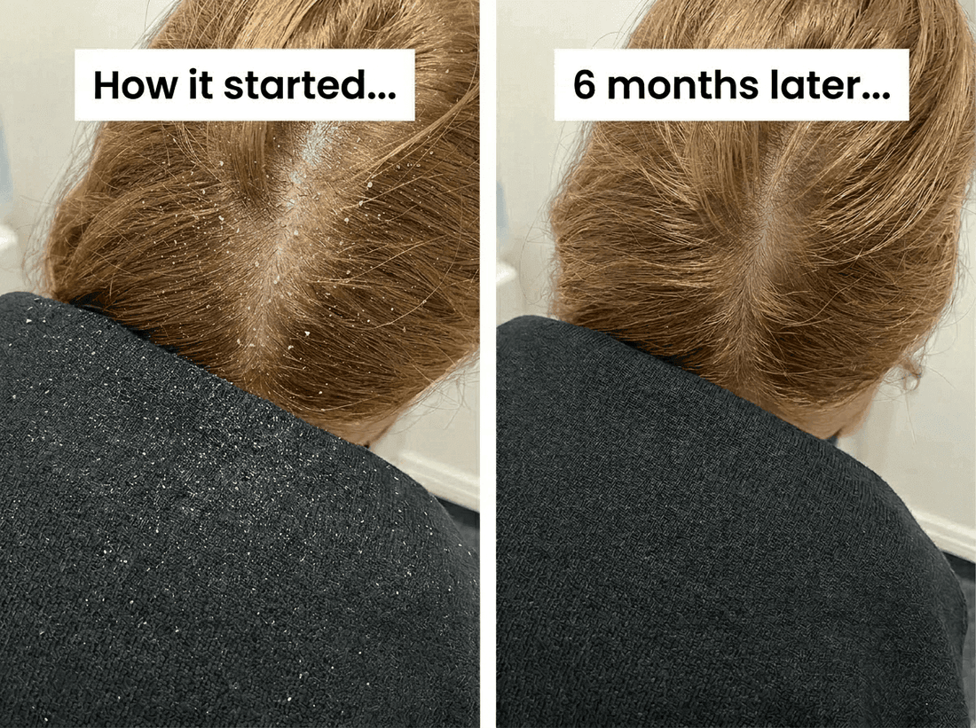 Before and after ScalpRoot
